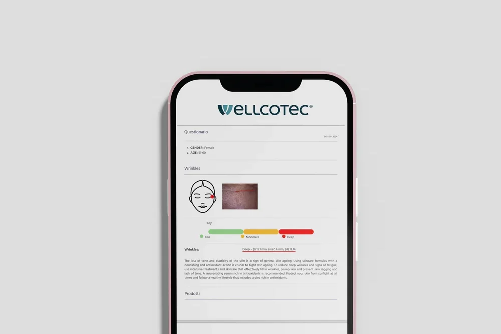Bericht des SOFT FX auf einem Smartphone mit WELLCOTEC-Logo, Musteransicht